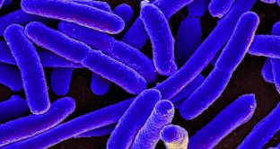 All’interno della tisana L’Angelica “Ventre piatto cold” sono stati trovati dei batteri fecali del tipo “escherichia coli”: le info.