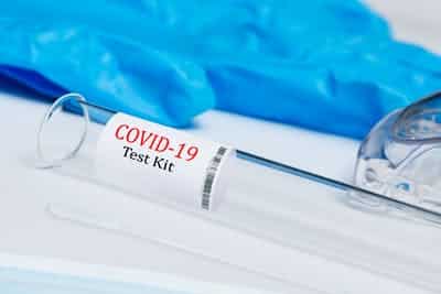 Spese per tampone Covid, dal fisco regole ad hoc per la detrazione nel 730